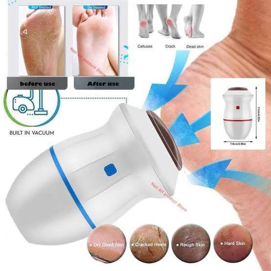 Automatic Electric Foot File & Callus Remover – Pedicure Grinder for Soft, Smooth Feet