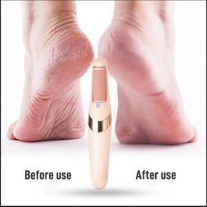USB Rechargeable Electric Foot File – Professional Callus Remover with Dual-Speed & LED Light for Smooth, Soft Feet