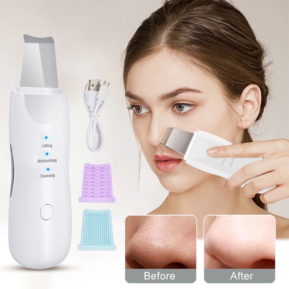 Ultrasonic Skin Scrubber – Deep Pore Cleanser, Blackhead Remover and Facial Peeling Device 5 Smart Home, Kitchen & Everyday Gadgets | XTylr Ultrasonic Skin Scrubber – Deep Pore Cleanser, Blackhead Remover and Facial Peeling Device - Image 5